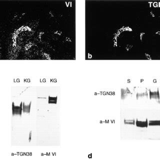 Association Of Myosin VI With The Golgi Complex NRK Cells Were Double