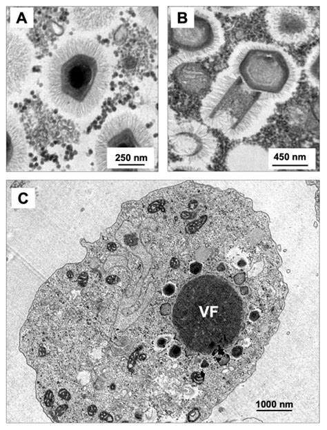 Transmission Electron Microscopy Of Mimivirus A And Tupanvirus Download Scientific Diagram