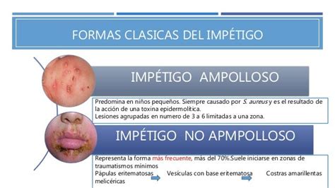 Enfermedades Dermatologicas