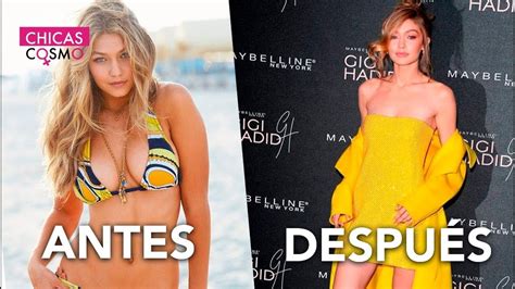 Gigi Hadid Confiesa Que Padece Una Terrible Enfermedad Youtube