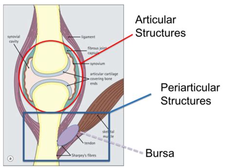 Approaching Joint Pain Flashcards Quizlet