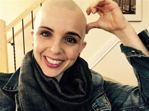 Just Bald Ottawa Woman Comes Clean About Life With Alopecia