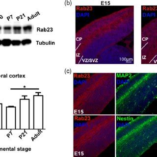 Emx1 Cre Driven Conditional Knockout Of Rab23 In The Cerebral Cortex