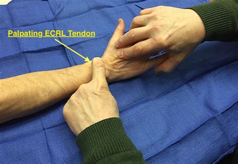 Muscle Test And Tendon Exam Extensor Carpi Radialis Longus Ecrl Hand Surgery Resource