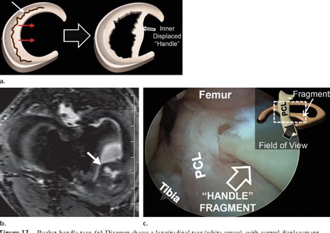 Figure 17 From MR Imaging Based Diagnosis And Classification Of