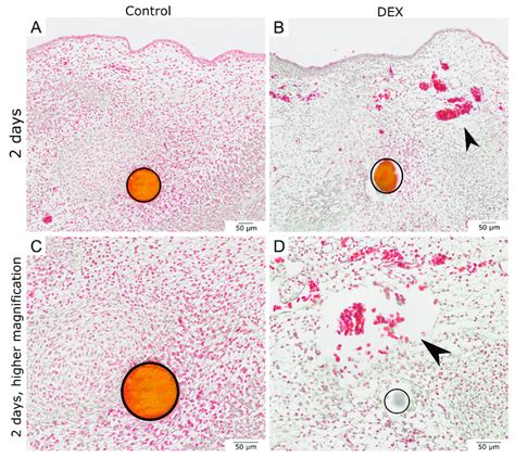 Masson Goldner Trichrome Staining Of Bead Implanted Wounds After Two