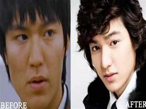 Korean Male Actors Without Plastic Surgery Lee Min Ho Plastic Surgery