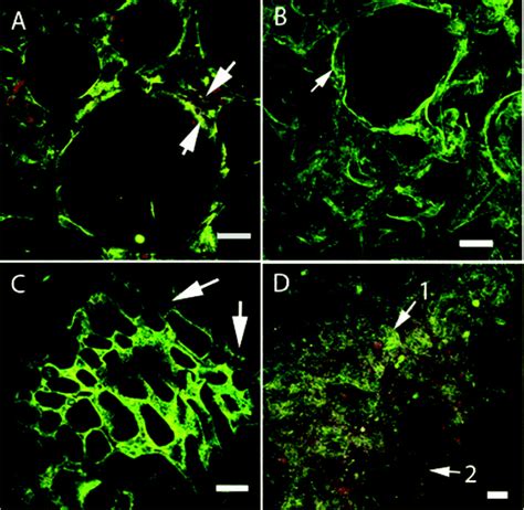Glutenin - Alchetron, The Free Social Encyclopedia 