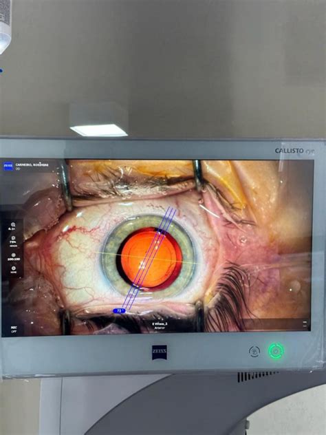 Oftalmologista Especialista em Cirurgia de Catarata CENTRO CIRÚRGICO