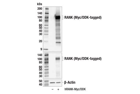 RANK (E2N2Y) Rabbit mAb | Cell Signaling Technology