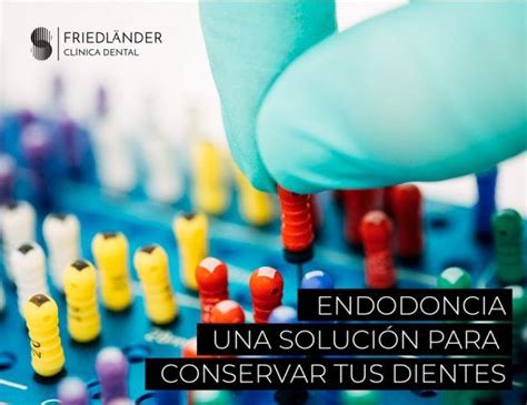 Endodoncia Qué es y en qué consiste Clínica Friedländer