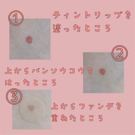 キズを早くきれいに治すパッチ｜matsukiyoの効果に関する口コミ ⭐️matsukiyo キズを早くきれいに治すパッチ⭐️ By てらっくま🕹 混合肌 20代後半 Lips