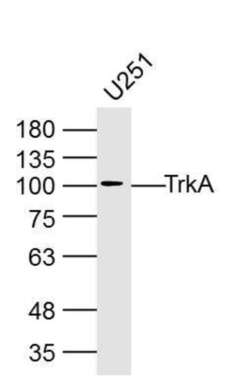 TrkA Rabbit anti Human Polyclonal Bioss 100 μL Unconjugated