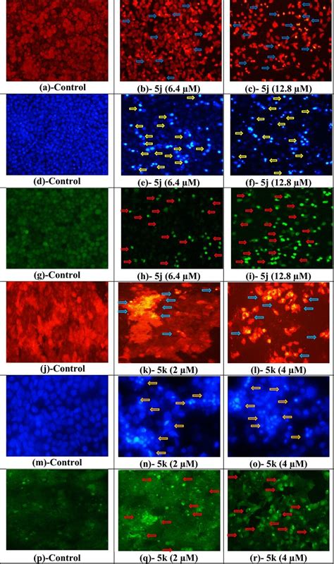 Fluorescence Photomicrographs Of Untreated Compound J Treated Hela