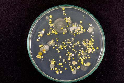 Characteristics And Different Shaped Colony Of Bacteria And Mold