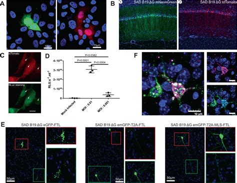 Research Team Creates Novel Rabies Viral Vectors For Neural Circuit Mapping