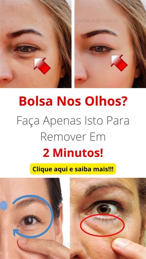 Bolsa Nos Olhos Faça Apenas Isto Para Remover Em 2 Minutos