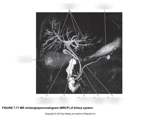 MRCP Abdomen Diagram Quizlet