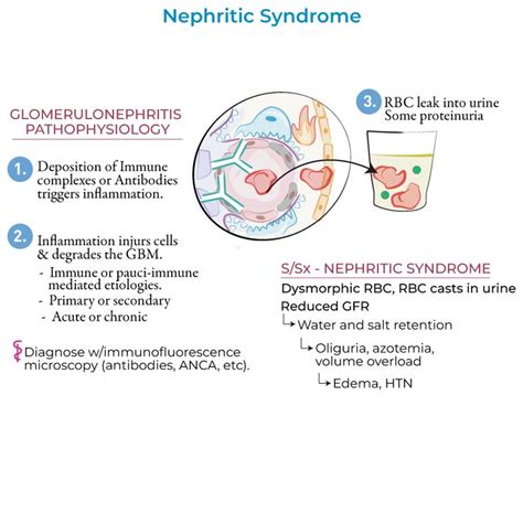 Nephritic Syndrome Here Well Learn About The Nephritic Syndrome