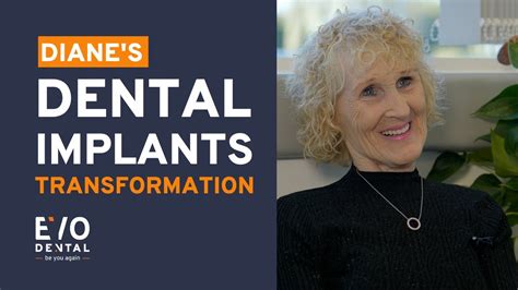 Diane S Dental Implant Transformation Smile In A Day YouTube