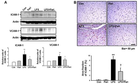 Paricalcitol Attenuates Lipopolysaccharide Induced Myocardial