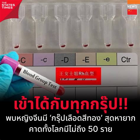 พบหญงจนม กรปเลอดสทอง สดหายาก คาดทงโลกมไมถง 50 ราย