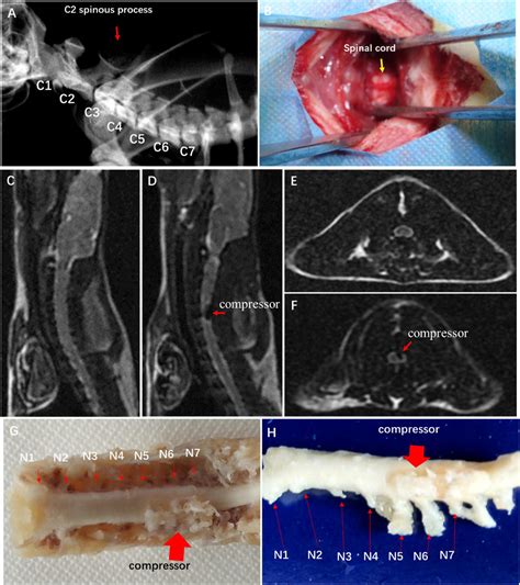 Frontiers Ultrastructural Destruction Of Neurovascular Unit In