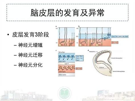 4步搞定腦皮層病變mri診斷：25種疾病聯合記！醫學影像經典ppt 每日頭條