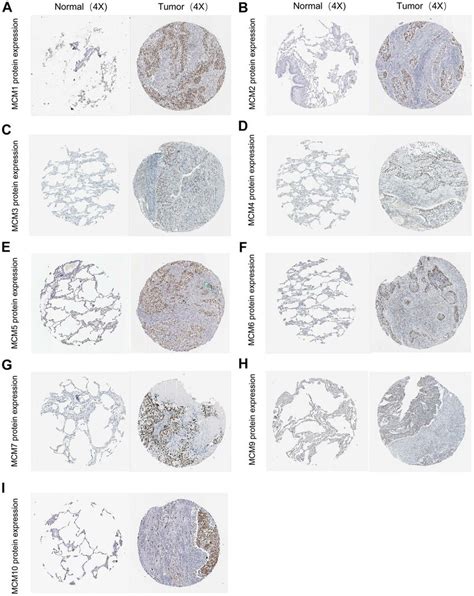 Typical Immunohistochemistry Images Of Minichromosome Maintenance Mcm