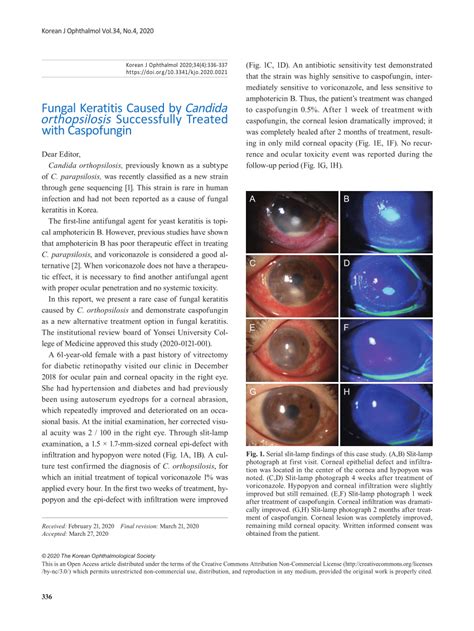 Pdf A Case Of Fungal Keratitis Caused By Candida Orthopsilosis Successfully Treated With