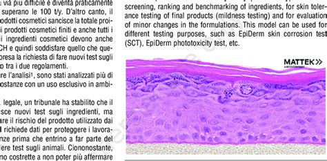 Histology Cross Section Of Epiderm Tissue Model Showing Organized