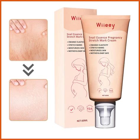 Pregnancy Belly Cream 60ml Belly Stretch Mark Cream Pregnancy with Snail Essence Non-greasy ...