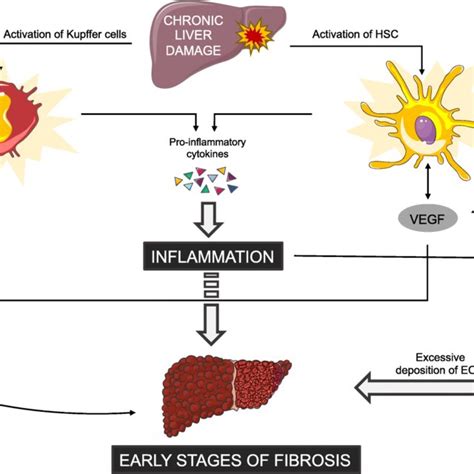 Link Between Angiogenesis Inflammation And Fibrosis In Chronic Liver