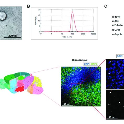 Neural Stem Cell Nsc Derived Exosomes Characterization A