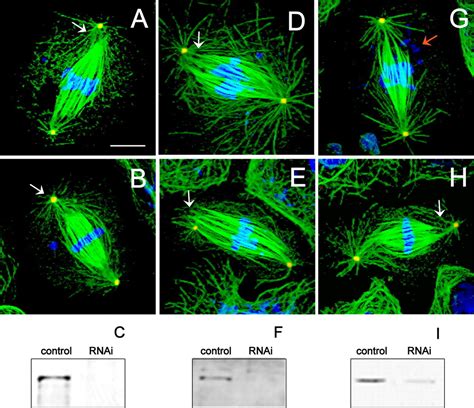 Spindle Pole Organization In Drosophila S2 Cells By Dynein Abnormal