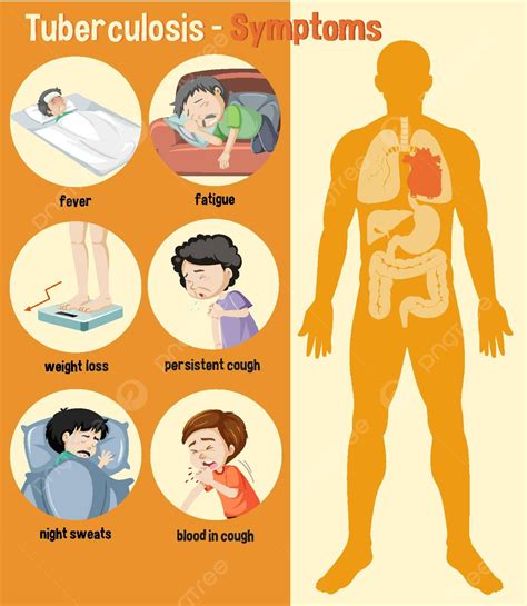 Tuberculosis Signs And Symptoms TB Symptoms + 5 Natural Ways to Prevent ...
