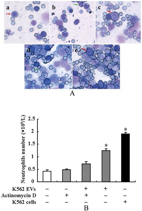 (A): Bone marrows in NOD/SCID mice. NOD/SCID mice were injected with... | Download Scientific ...