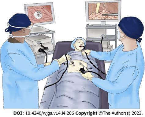 Laparoscopic-assisted endoscopic gastrostomy tube placement. | Download ...