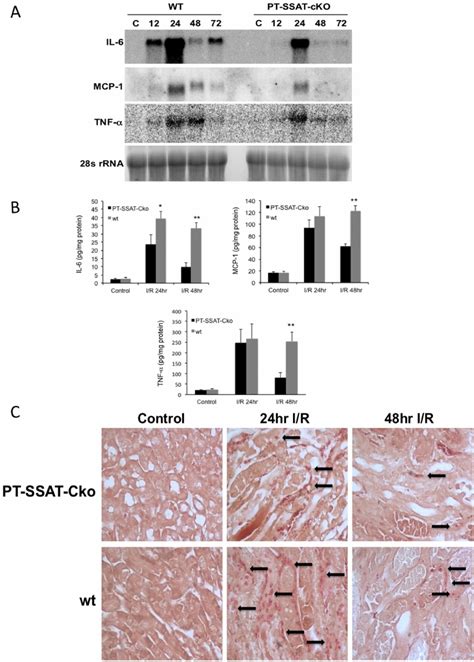 Expression Of Pro Inflammatory Cytokines And Neutrophil Infiltration