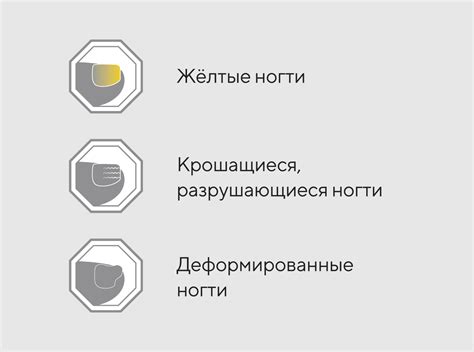 Миколепт® лак. Официальный сайт продукции