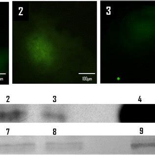 Co-localization of GFP fluorescence and α-GFP immunofluorescence in... | Download Scientific Diagram