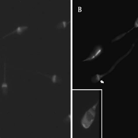 Detection Of Heparin Binding By Fluorescent Microscopy Fluorescent