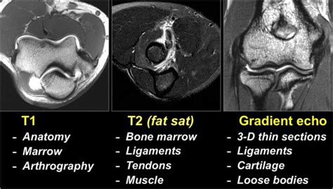 The Radiology Assistant : MRI examination of the Elbow