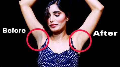 How To Get Rid Of Dark Underarms Dark Underarms Home Remedy Whiten