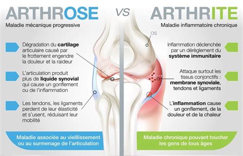 Arthrose Ou Arthrite Nath Urellement