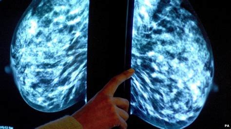 Breast Cancer The Risks And Treating The Disease Bbc News