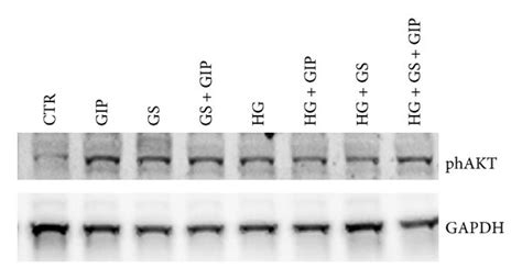 Treatment With Gs Abrogates Gip Induced Phosphorylation Of Akt Ser473 Download Scientific