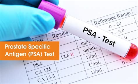 Prostate Specific Antigen Psa Test By Unipath Specialty Laboratory