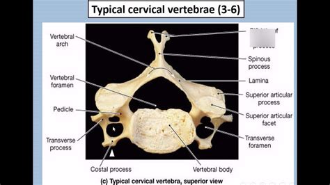 Diagram Of Typical Cervical Vertebrae