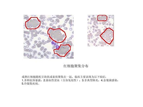 1 常见血液细胞学图谱word文档在线阅读与下载无忧文档